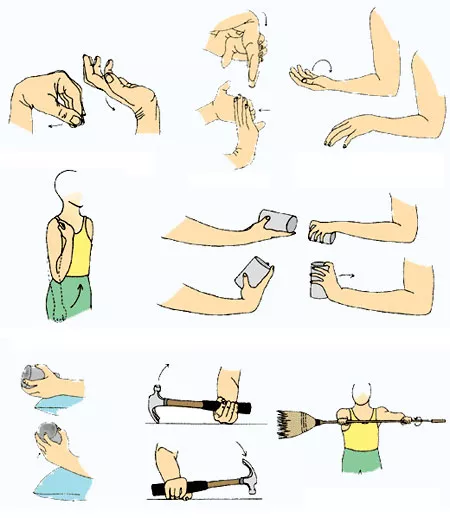Изображение - Как восстановить сустав после вывиха lokot-reabilitacia